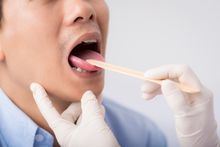 What Your Tongue Reveals About Your Health